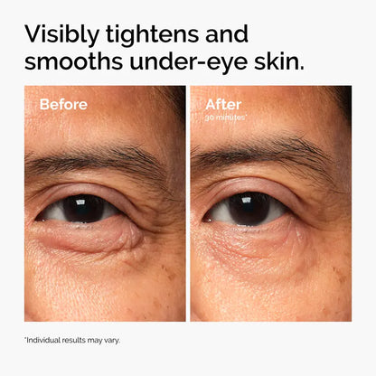 Lacto-PDRN 4% + B9 Firming & Brightening Eye Cream for Fine Lines & Dark Circles | Buy 2 Get 1 Free