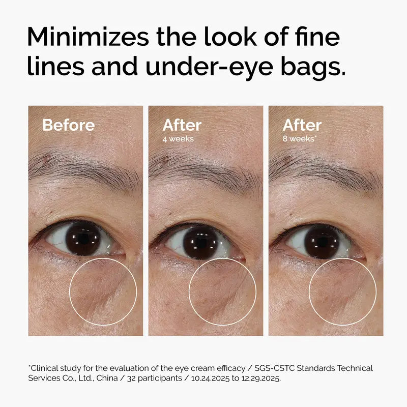 Lacto-PDRN 4% + B9 Firming & Brightening Eye Cream for Fine Lines & Dark Circles | Buy 2 Get 1 Free