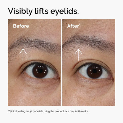 Lacto-PDRN 4% + B9 Firming & Brightening Eye Cream for Fine Lines & Dark Circles | Buy 2 Get 1 Free